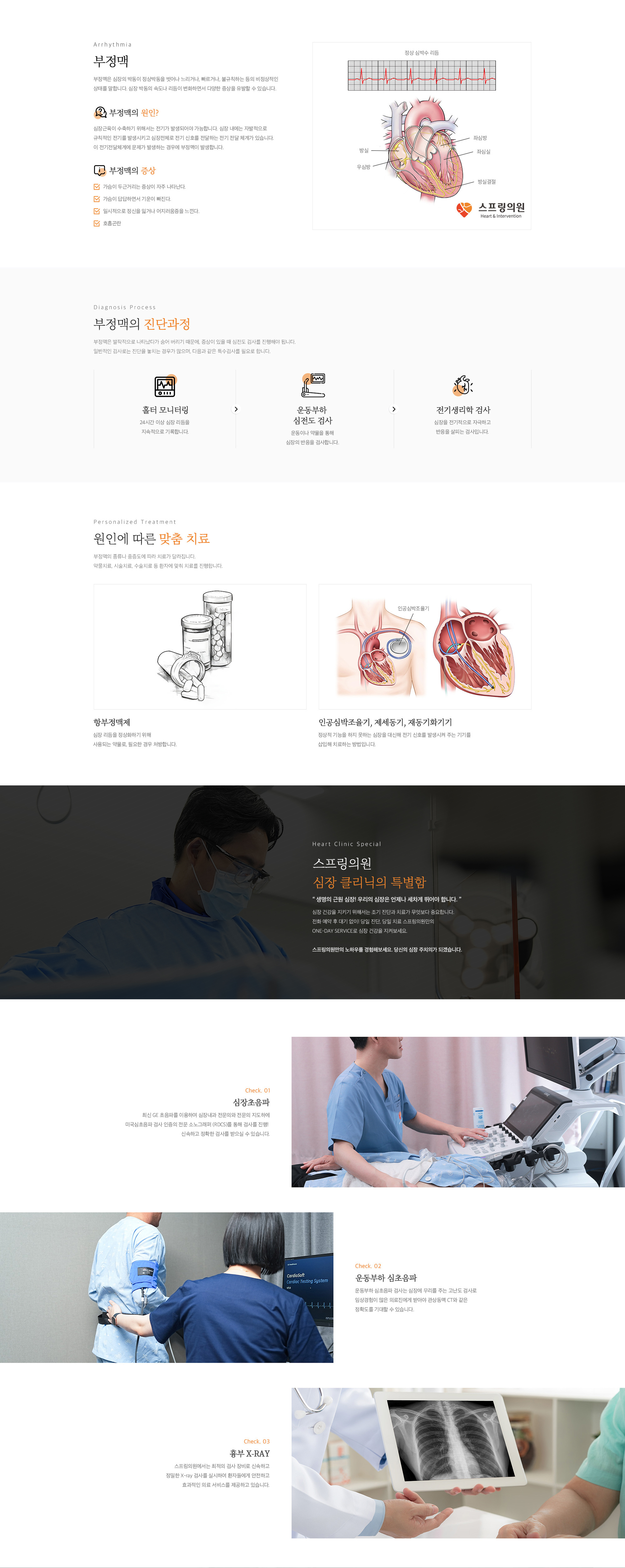 부정맥